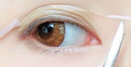 内双的MM如何贴双眼皮