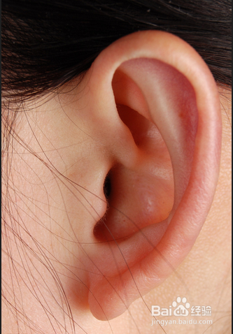 耵聍对生活的影响及如何正确挖取耵聍