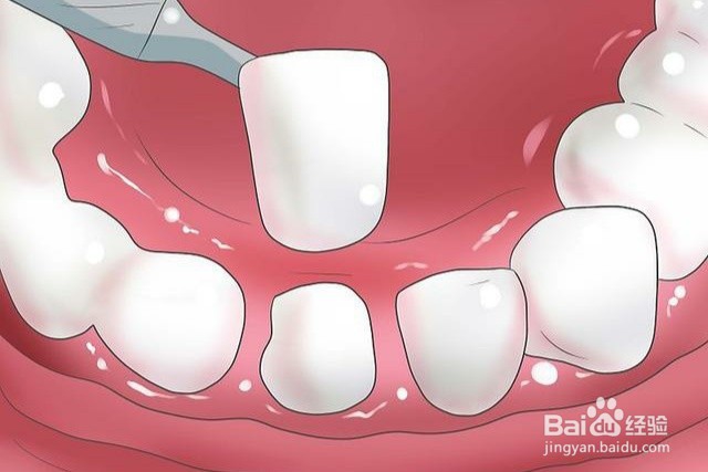 如何避免口臭情况？