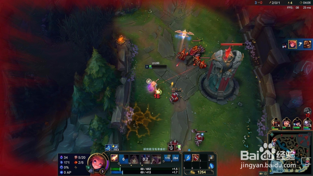 英雄联盟暮光星灵佐伊怎么玩