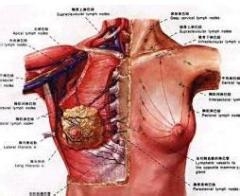 乳腺癌晚期症状都有哪些