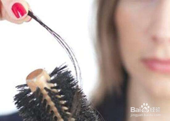 年轻人怎么预防脱发呢?