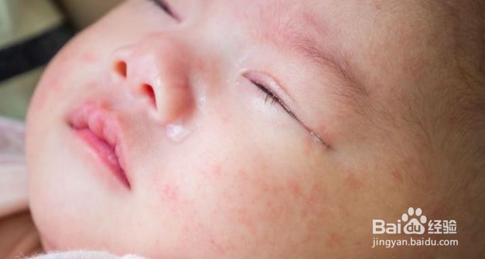 不同体质的宝宝怎么挑选奶粉？