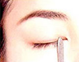 怎样快速贴好双眼皮