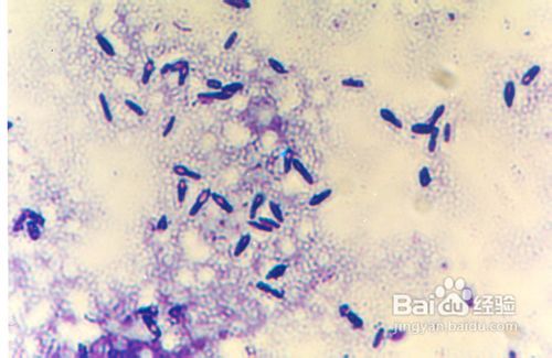 得了胃病吃什么好?