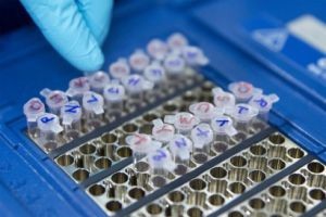 7大异常阻挡马来西亚试管婴儿成功