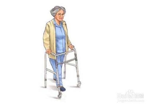 关节置换后怎样康复锻炼