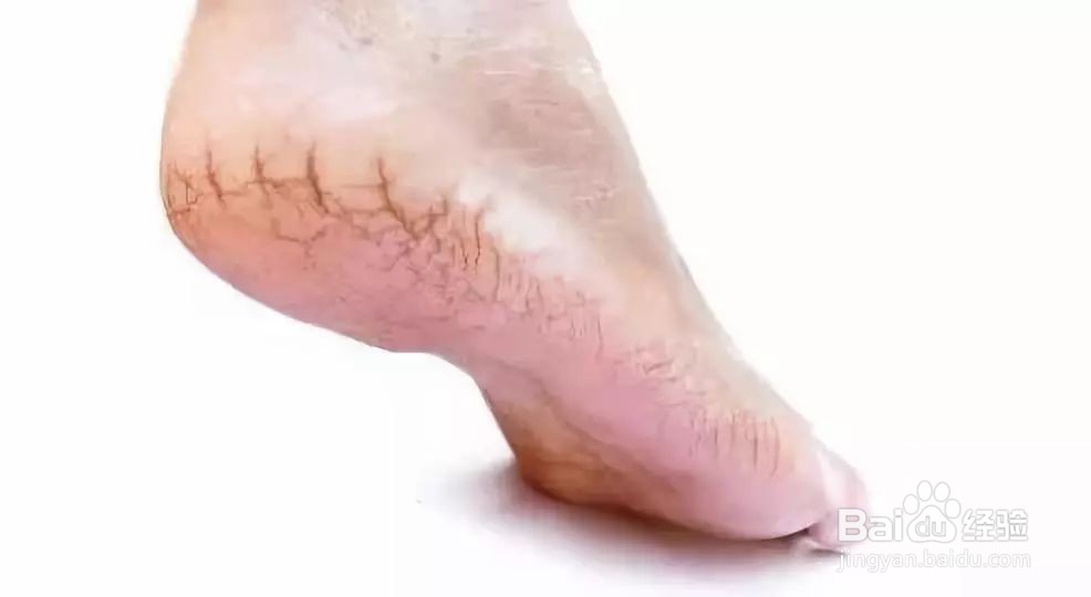 如何防止起皮？