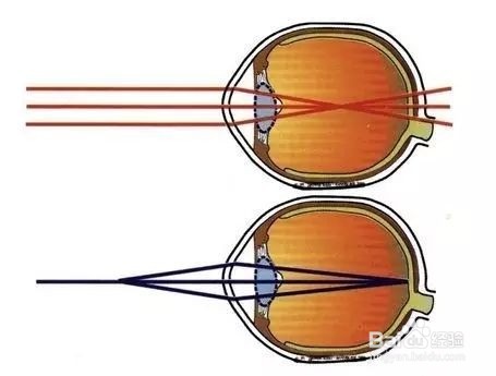 弱视家长最关心的问题(一)