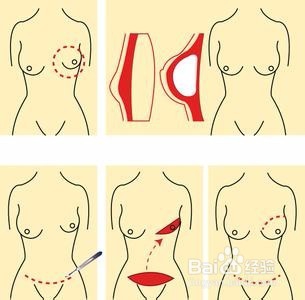 如何保养女生的8大脆弱部位?