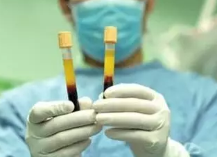 什么是填脂肪、自体脂肪填充大约需要多少钱？