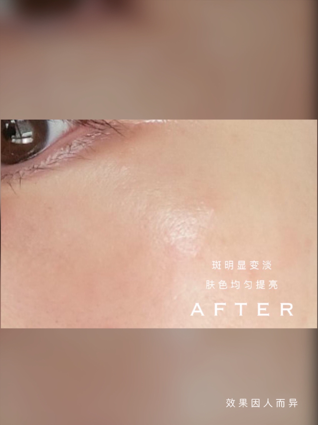 空瓶是真爱!科颜氏淡斑精华真正值得回购