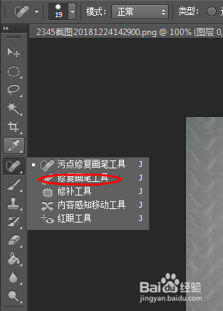 祛痘印最快的方法