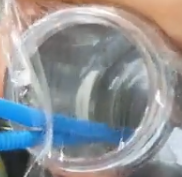怎样制作75%家庭消毒酒精？