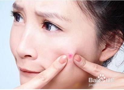 脸上总是长痘痘的四个因素