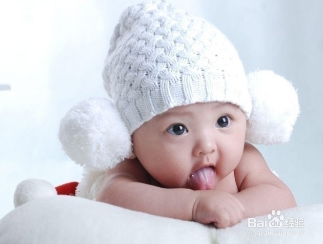 新生儿生理性黄疸和病理性黄疸的区别