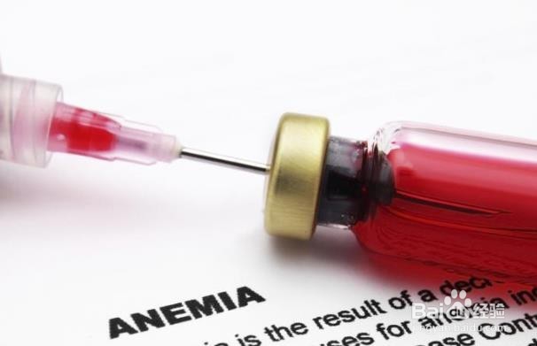 结肠癌的十大体征