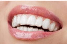 牙颌畸形的4种不良习惯