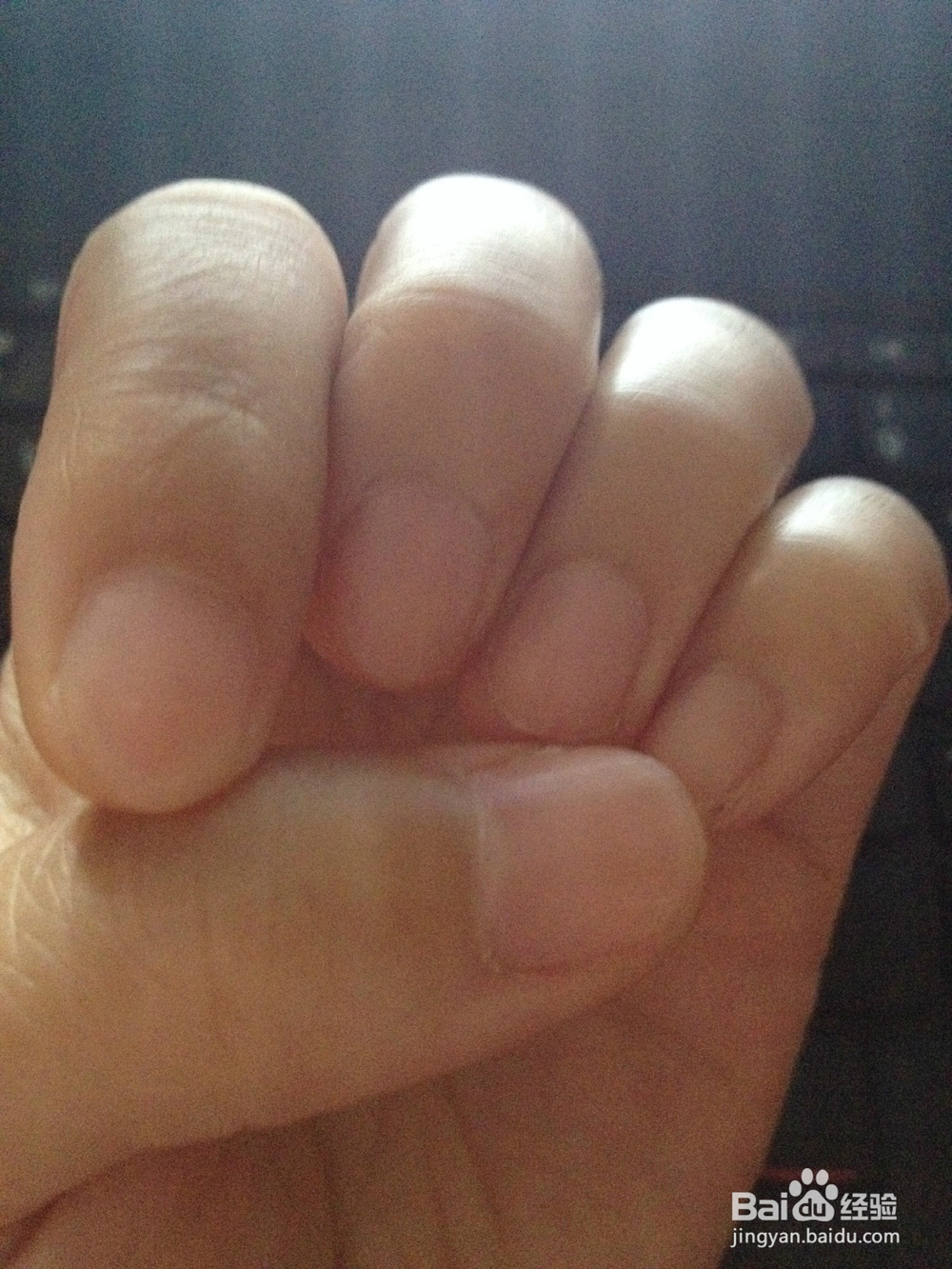 怎么判断自己气血是否充足