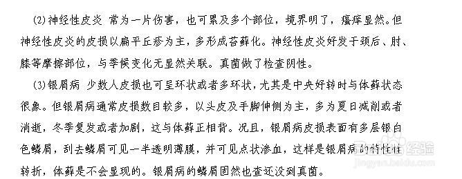 体藓怎么治好呢