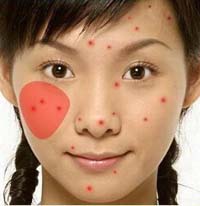 通过外表症状看里面的病