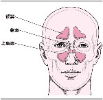 预防鼻窦炎的方法有哪些