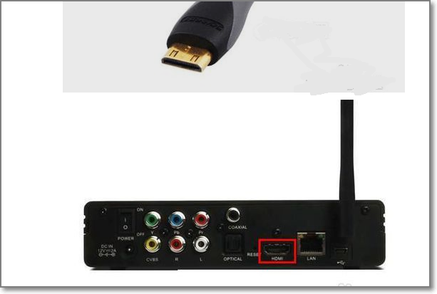 网络机顶盒怎么安装图
