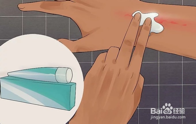 如何治疗皮肤过敏现象