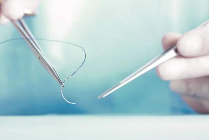 伤口缝针可以吃鸭肉吗