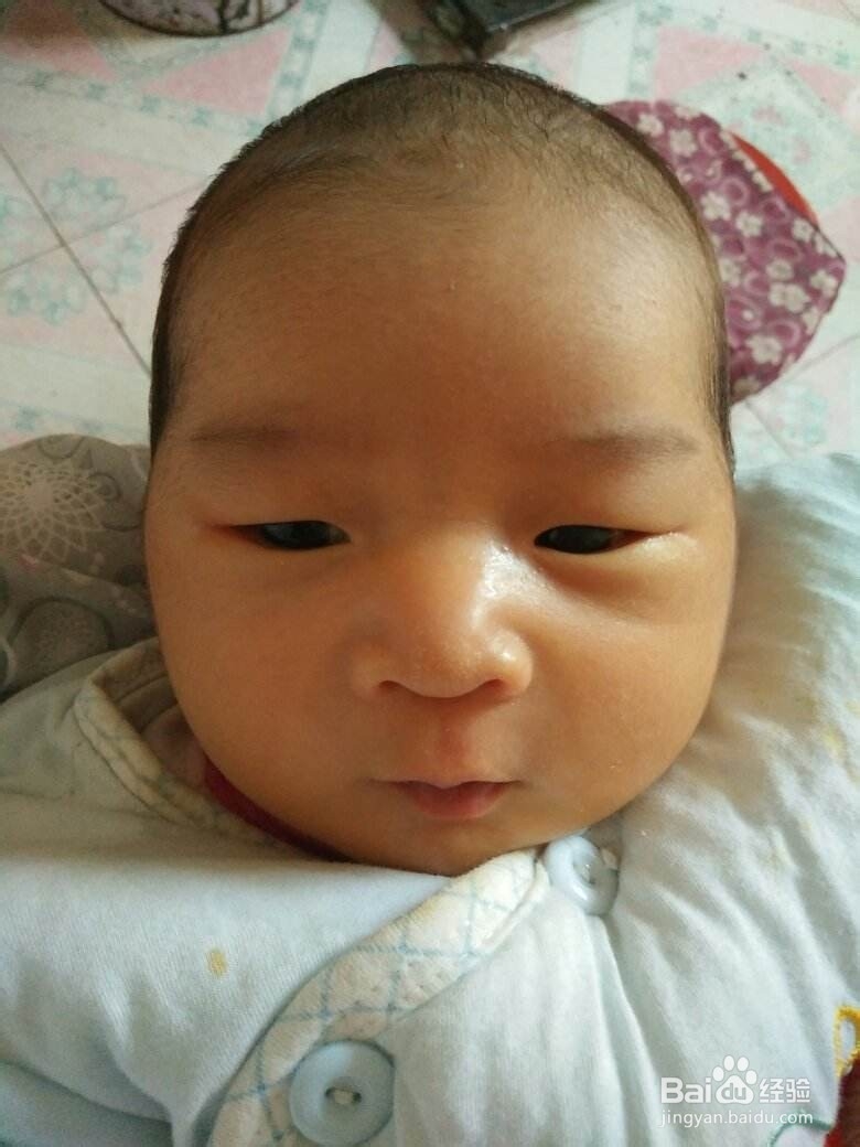 宝宝满月了脸还有点黄怎么办