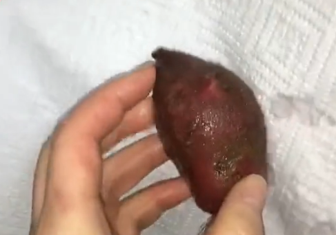 微波炉怎么的烤红薯