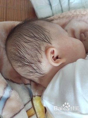 宝宝缺钙有哪些症状？