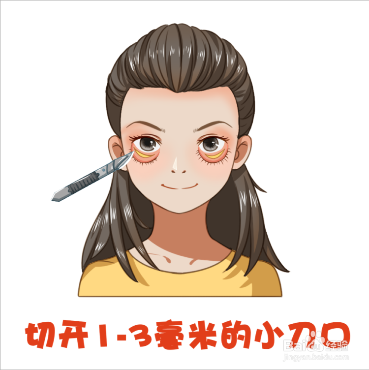 什么是割眼袋有什么危害