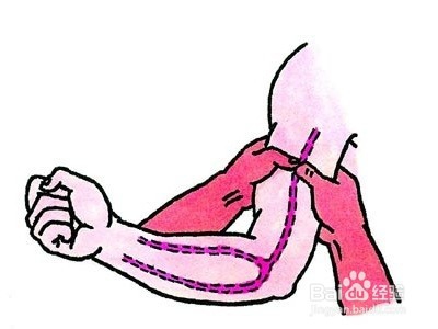 外出血的止血方法