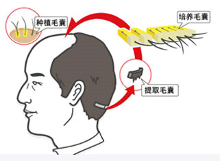 杭州植发整形价格