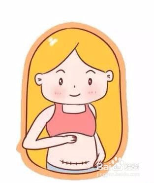 剖腹产后，产妇要注意什么事情？