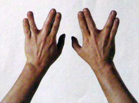 弹筝者怎样锻炼手指的灵活度