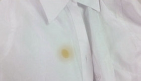 怎么去除衣服上的油渍?