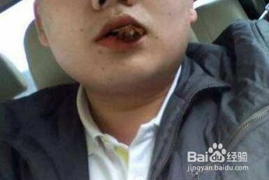 保护牙齿最全面的方法,让你拥有健康牙齿!