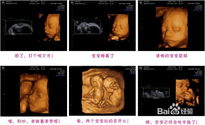 如何减少怀孕期间的相关费用