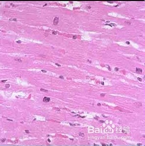 关于心肌疾病的临床图片。