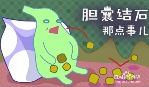 胆宁片可以长期吃吗？胆宁片吃多久停药？