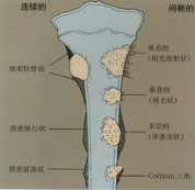 种植骨膜∪F面使用方法