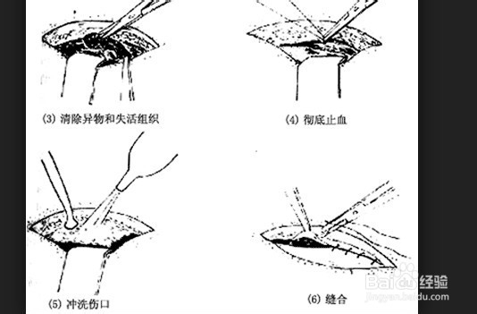 伤口愈合慢是什么原因
