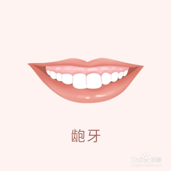 牙齿矫正类型