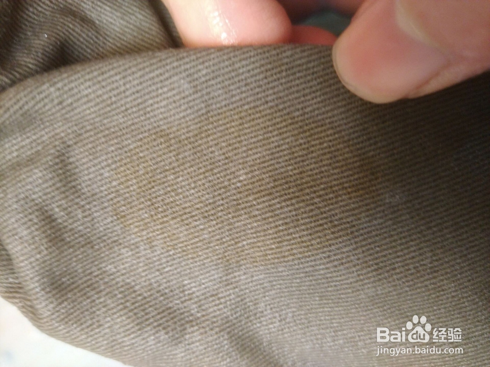 碘酒、碘伏弄到衣服上了怎么办?