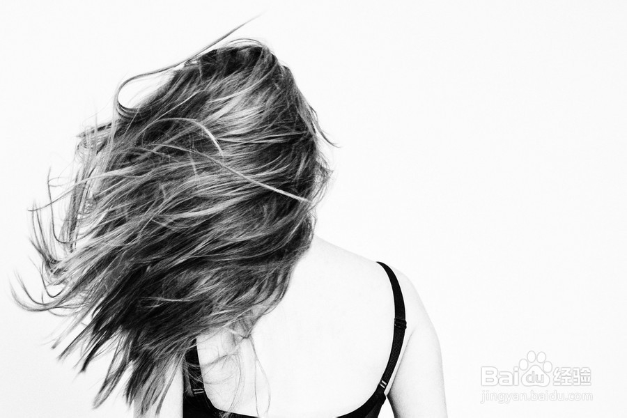 在天津有脂溢性脱发种头发要怎么办？