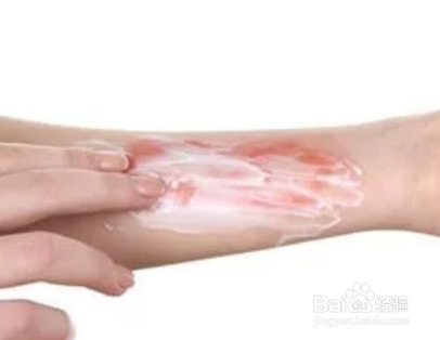 疤克盖子怎么打开