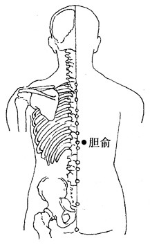 百病刮痧：[44]带状疱疹的刮痧疗法