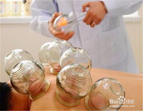 如何正确拔火罐